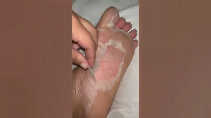Foot Peel Mask | Foot Care Treatment | Foot Mask Results | Baby Soft Feet | Plantifique | shorts